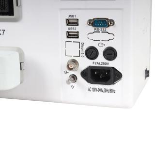 УЗИ сканер Med-Mos CMS600B3